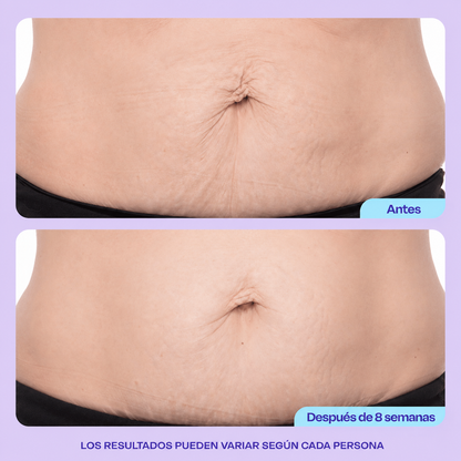 SOMNOVA™ Crema Reafirmante Abdomen