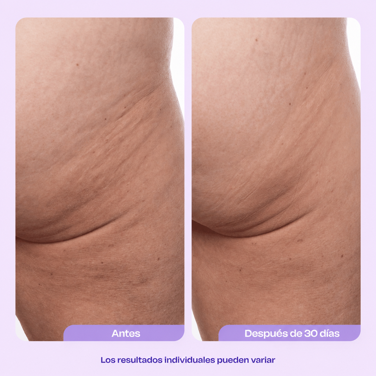 SOMNOVA™ Crema Reafirmante Muslos & Glúteos
